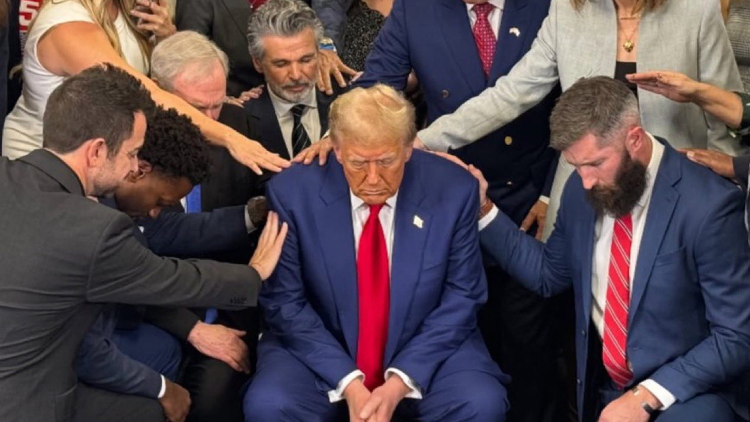 Trump Chronic Venous Insufficiency Diagnosed in 2025